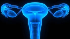 fibrome, un obstacle pour les femmes en âge de procréer