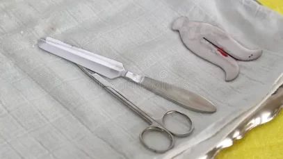 Circoncision.webp.webp