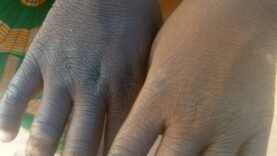 Choc à Pala : Un Enfant de 4 Ans Brûlé par sa Marâtre – Les Détails Troublants que Vous Ignorez