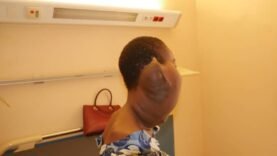 Une fillette hospitalisée au CHU La Renaissance pour une masse au cou : des craintes sur son état de santé.