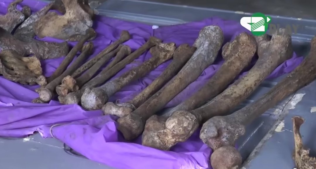 Douala : arrestation d&rsquo;un homme avec des ossements humains